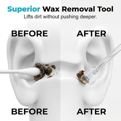 Earwax Cleaning Sticks – 24 Pack